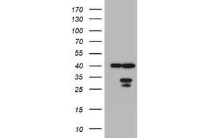 Image no. 1 for anti-Mitochondrial Translational Initiation Factor 3 (MTIF3) (AA 56-278) antibody (ABIN1491592) (MTIF3 Antikörper  (AA 56-278))