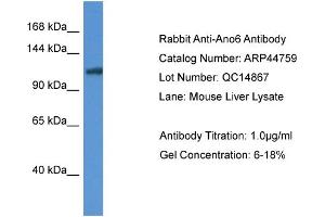 WB Suggested Anti-Ano6 Antibody   Titration: 1. (Anoctamin 6 Antikörper  (Middle Region))