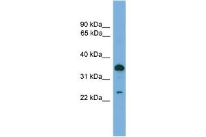 WB Suggested Anti-TPD52 Antibody Titration:  0. (TPD52 Antikörper  (C-Term))