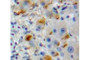 IHC-P analysis of Liver tissue, with DAB staining. (DCL1 Antikörper  (AA 23-232))