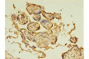 Immunohistochemistry of paraffin-embedded human placenta tissue using ABIN7145885 at dilution of 1:100