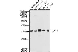 Western blot analysis of extracts of various cell lines, using GNB3 antibody (ABIN1680055, ABIN3015467, ABIN3015468 and ABIN6218020) at 1:1000 dilution. (GNB3 Antikörper  (AA 1-230))