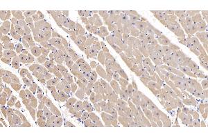 Detection of MYH2 in Human Cardiac Muscle Tissue using Polyclonal Antibody to Myosin Heavy Chain 2 (MYH2) (MYH2 Antikörper  (AA 1237-1471))