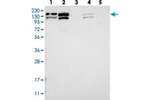 Western blot analysis of Lane 1: RT-4, Lane 2: U-251 MG, Lane 3: Human Plasma, Lane 4: Liver, Lane 5: Tonsil with CCAR1 polyclonal antibody . (CCAR1 Antikörper)