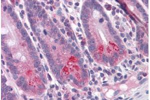 Human Small Intestine: Formalin-Fixed, Paraffin-Embedded (FFPE) (BIRC6 Antikörper  (C-Term))