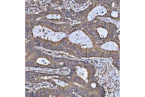 IHC analysis of HSD17B7 using anti-HSD17B7 antibody (ABIN7600174). (HSD17B7 Antikörper  (AA 16-336))