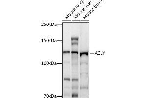 Western blot analysis of extracts of various cell lines, using ACLY antibody (ABIN7265716) at 1:1000 dilution. (ACLY Antikörper  (AA 752-1101))