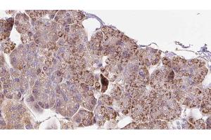ABIN6273288 at 1/100 staining Human pancreas cancer tissue by IHC-P. (PCCA Antikörper  (C-Term))