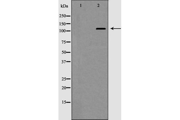 HDAC5 Antikörper  (C-Term)