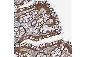 Immunohistochemical staining of human colon with ST8SIA6 polyclonal antibody  shows strong cytoplasmic positivity in glandular cells at 1:50-1:200 dilution. (ST8SIA6 Antikörper)