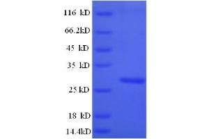 SDS-PAGE (SDS) image for Cathepsin K (CTSK) (AA 115-329) protein (His tag) (ABIN5709361) (Cathepsin K Protein (CTSK) (AA 115-329) (His tag))
