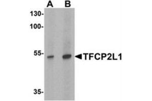 Western blot analysis of TFCP2L1 in human colon tissue lysate with TFCP2L1 antibody at (A) 1 and (B) 2 ug/mL