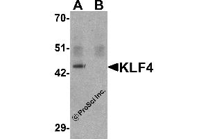 Western Blotting (WB) image for anti-Kruppel-Like Factor 4 (Gut) (KLF4) antibody (ABIN1031709) (KLF4 Antikörper)