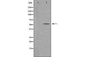 Western blot analysis of extracts of various cell lines, using MSR1 antibody. (Macrophage Scavenger Receptor 1 Antikörper  (N-Term))