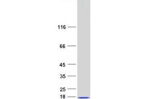 Western Blotting (WB) image for C-Myc Binding Protein (MYCBP) protein (Myc-DYKDDDDK Tag) (ABIN2726630)