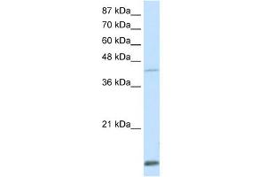 WB Suggested Anti-MKX Antibody Titration:  0. (MKX Antikörper  (Middle Region))
