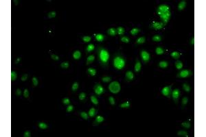 Immunofluorescence analysis of U20S cell using HOXB7 antibody.