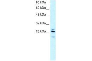 Human brain; WB Suggested Anti-RGS20 Antibody Titration: 2. (RGS20 Antikörper  (all Isoforms, Middle Region))