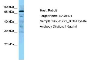 WB Suggested Anti-SAMHD1 Antibody Titration: 0. (SAMHD1 Antikörper  (Middle Region))
