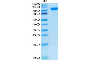 SDS-PAGE (SDS) image for AXL Receptor tyrosine Kinase (AXL) (AA 26-449) protein (Fc Tag) (ABIN7273882)