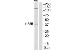 Western blot analysis of extracts from K562 cells, using eIF2B (Ab-67) antibody. (EIF2S2 Antikörper  (N-Term))