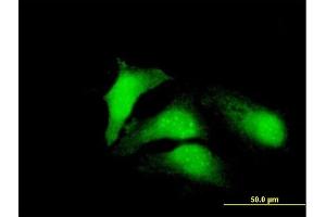Immunofluorescence of purified MaxPab antibody to CDCA8 on HeLa cell. (CDCA8 Antikörper  (AA 1-280))