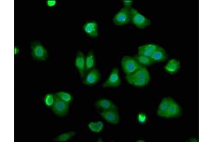 Immunofluorescence staining of HepG2 cells with ABIN7143477 at 1:100, counter-stained with DAPI. (ARL11 Antikörper  (AA 2-196))