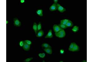 Immunofluorescence staining of HepG2 cells with ABIN7143477 at 1:100, counter-stained with DAPI. (ARL11 Antikörper  (AA 2-196))