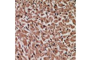 Immunohistochemical analysis of MYCBP staining in human heart formalin fixed paraffin embedded tissue section. (MYCBP Antikörper)