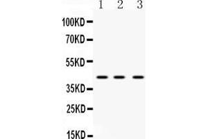 Western blot analysis of HnRNP F expression in rat liver extract ( Lane 1), mouse spleen extract ( Lane 2) and HELA whole cell lysates ( Lane 3).