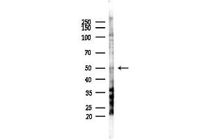 Western blot analysis of lysates from COLO205 cells(heat-shock,45 min treatment), using KCN Antibody at 1/1000 dilution.
