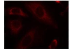 Image no. 2 for anti-Protein tyrosine Phosphatase, Non-Receptor Type 11 (PTPN11) (Tyr542) antibody (ABIN197594)