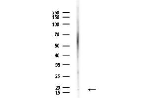 anti-Jumping Translocation Breakpoint (JTB) (Internal Region) antibody