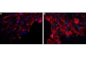 Expression of P2RX3 in rat DRG - Immunohistochemical staining of rat dorsal root ganglion (DRG) frozen sections using Anti-P2X3 Receptor (extracellular) Antibody (ABIN7043422, ABIN7045098 and ABIN7045099), followed by anti-rabbit-AlexaFluor-594 secondary antibody. (P2X3 Receptor (AA 65-79), (Extracellular) Antikörper)