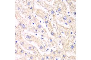Immunohistochemistry of paraffin-embedded human liver injury using PSMF1 antibody at dilution of 1:100 (x40 lens). (PSMF1 Antikörper)