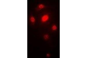 Immunofluorescent analysis of ORC6 staining in SW620 cells.