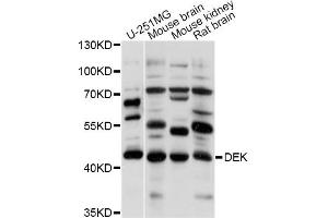 Western blot analysis of extracts of various cell lines, using DEK antibody (ABIN5995944) at 1/1000 dilution. (DEK Antikörper)