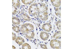Immunohistochemistry of paraffin-embedded human stomach using CTSC antibody at dilution of 1:100 (x40 lens). (CTSC Antikörper)