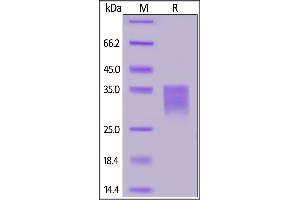 Human Her2 (498-648), His Tag on  under reducing (R) condition. (ErbB2/Her2 Protein (AA 498-648) (His tag))