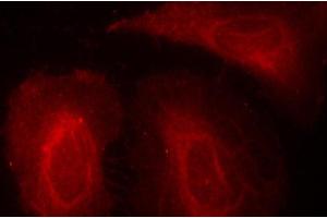Immunofluorescence staining of methanol-fixed Hela cells, using Phospho-PDPK1-S241 antibody.