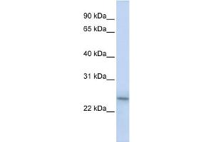 WB Suggested Anti-PSMB9 Antibody Titration:  0. (PSMB9 Antikörper  (C-Term))