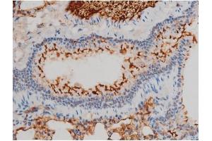 Immunohistochemistry (IHC) image for anti-Ezrin (EZR) (pTyr478) antibody (ABIN6255926)