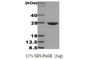 Figure annotation denotes ug of protein loaded and % gel used. (HSP27 Protein)