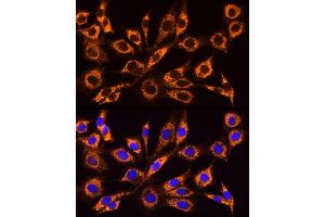 Immunofluorescence analysis of NIH/3T3 cells using  Rabbit pAb (ABIN6129864, ABIN6136458, ABIN6136459 and ABIN6222564) at dilution of 1:100 (40x lens). (ACSL4 Antikörper  (AA 1-280))