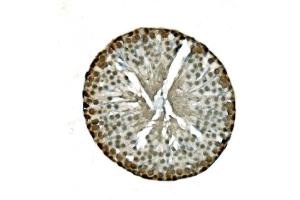 IHC analysis of LSM8 using anti-LSM8 antibody (ABIN7599579). (NAA38 Antikörper  (AA 1-96))