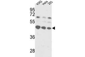 Western blot analysis of SS-B antibody and K562, HeLa, 293 lysate. (SSB Antikörper  (AA 366-397))