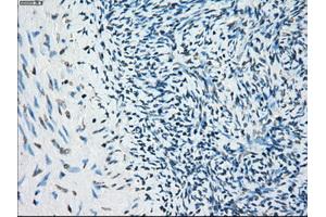 Immunohistochemistry (IHC) image for anti-Budding Uninhibited By Benzimidazoles 1 Homolog beta (Yeast) (BUB1B) antibody (ABIN1496996) (BUB1B Antikörper)