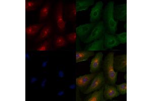 ABIN6261879 and ABIN6277946 staining  cells by IF/ICC. (GAP43 Antikörper  (C-Term))