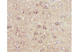 IHC-P: Amyloid beta antibody testing of mouse brain tissue (APP Antikörper  (C-Term))