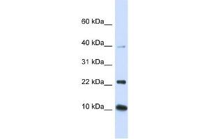 UBE2D2 antibody used at 1 ug/ml to detect target protein.